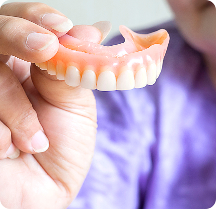 Prótese Fixa sobre Implantes